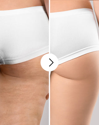 Cellulit elleni és bőrállapotot javító tabletták természetes kivonatokkal - Cellinea, 60 kapszula - 4