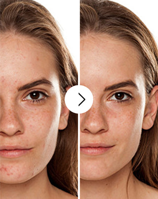 Derminax pattanások, akné és bőrhibák elleni tabletta cinkkel, C, E és B2 vitaminnal - 6