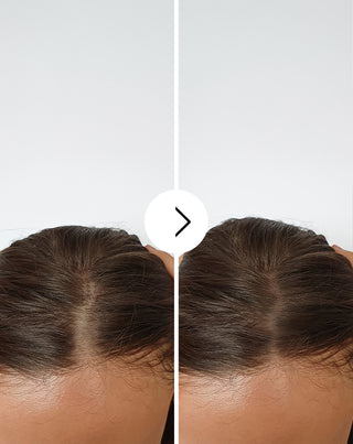 Hajhullás elleni kapszulák, sűrítő és erősítő hatással - Follixin, 60 kapszula_4 - 4