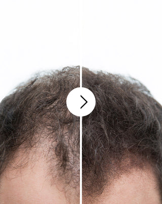 Hajhullás elleni kapszulák, sűrítő és erősítő hatással - Follixin, 60 kapszula - 6