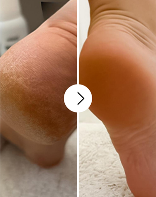 Nutridome lágyító lábkrém karbamiddal és shea vajjal - 4