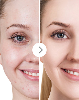 Derminax pattanások, akné és bőrhibák elleni tabletta cinkkel, C, E és B2 vitaminnal - 5