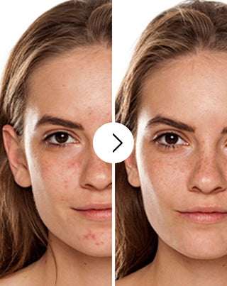 Derminax pattanások, akné és bőrhibák elleni tabletta cinkkel, C, E és B2 vitaminnal_2 - 2