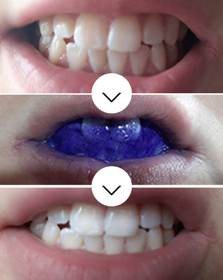 Smilebite színkorrekciós fogszín-korrigáló szérum 30 ml-es - 3