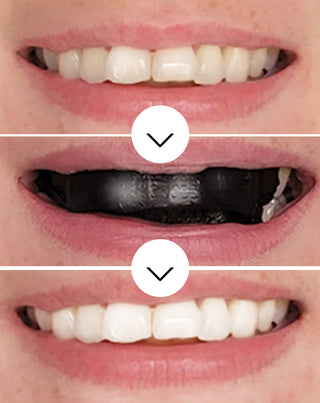 Smilebite fogfehérítő csíkok - 28 darabos készlet - 3