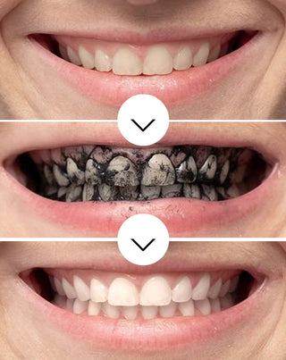 Smilebite fogfehérítő por kókusz szénnel - 3